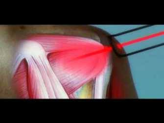 %cf%80%cf%81%ce%bf%cf%83%ce%ba%cf%81%ce%bf%cf%85%cf%83%ce%b7-%cf%89%ce%bc%ce%bf%cf%85